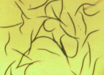 Nematoden gegen Maulwurfsgrillen u.a. 6 Mio. für 12m² 